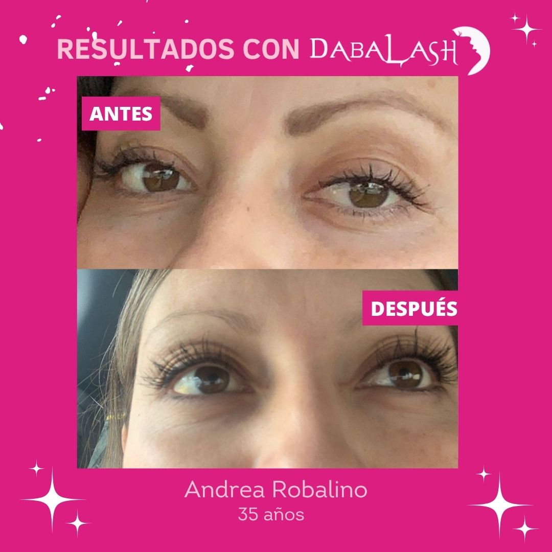 Testimonios de crecimiento de pesta&ntilde;as 